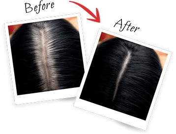 Plaukų šaknų maskuoklis L'OREAL Magic Retouch 1 aprašymas - Prekės nuotrauka