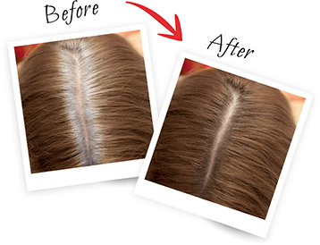 Plaukų šaknų maskuoklis L'OREAL Magic Retouch 4 aprašymas - Prekės nuotrauka