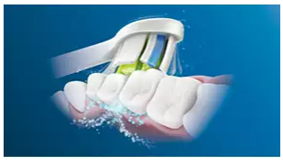 Philips Sonicare ProtectiveClean 6100 Sonic elektrinis dantų šepetėlis HX6877/28 aprašymas - Prekės nuotrauka
