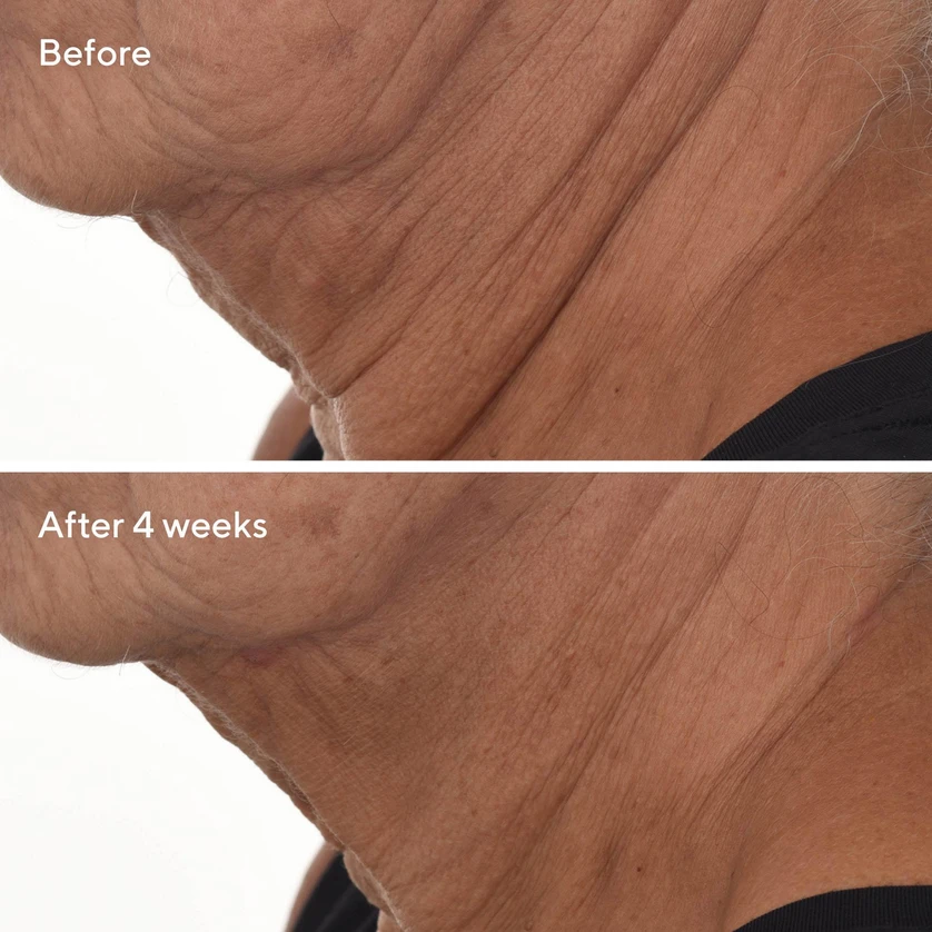 Veido ir kaklo serumas Murad Skincare Retinal Resculpt Overnight Treatment, 30 ml aprašymas - Prekės nuotrauka