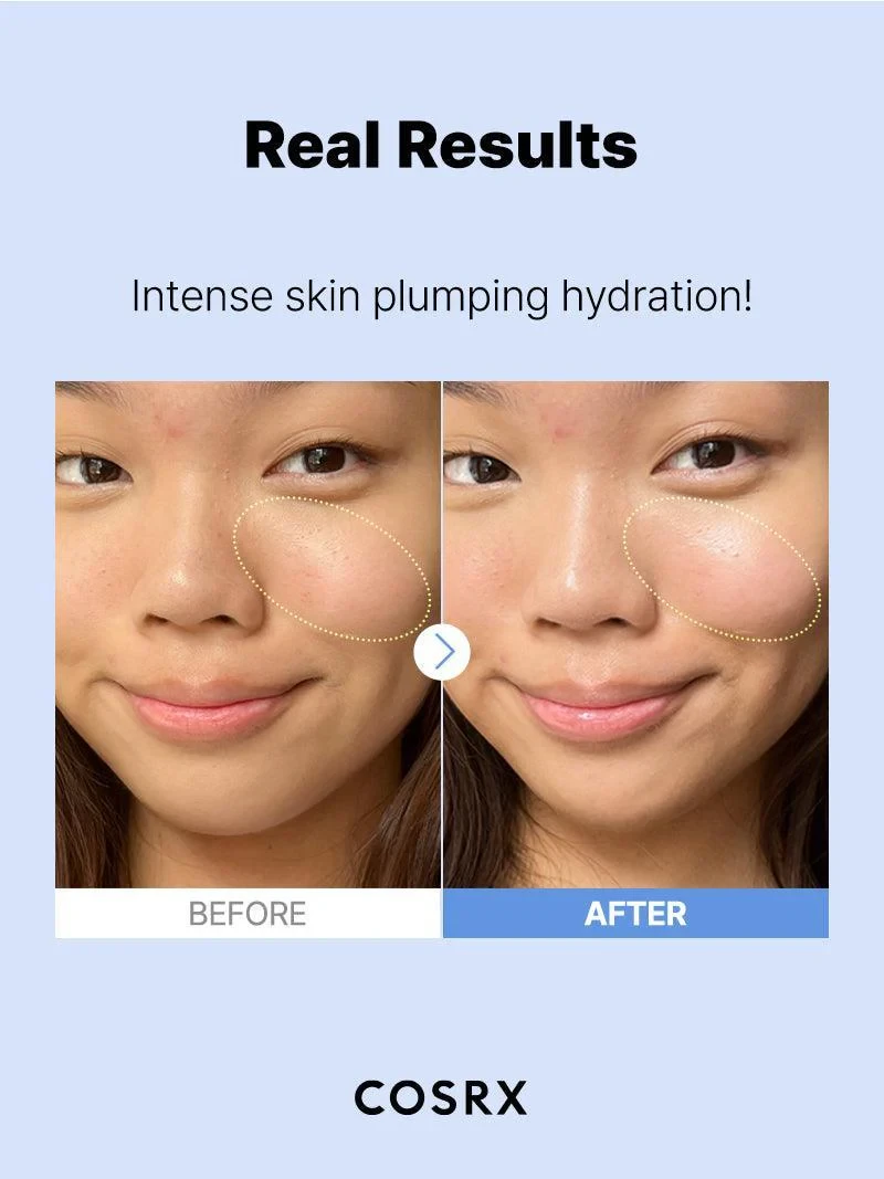 COSRX The Hyaluronic Acid 3 Serum Intensyviai drėkinantis serumas su 3% hialurono rūgštimi, 20 ml aprašymas - Prekės nuotrauka