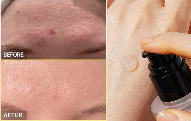 Cosrx Advanced Snail 96 Mucin Power Essence Veido esencija su sraigių mucinu, 100 ml aprašymas - Prekės nuotrauka