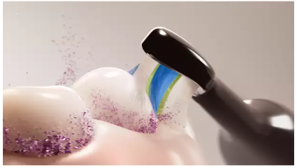 Philips Sonicare Series 5300 „Sonic“ elektrinis dantų šepetėlis HX7101/02 aprašymas - Prekės nuotrauka